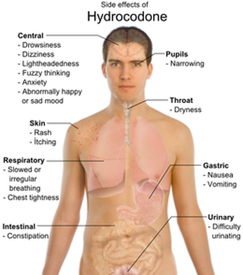 hydrocodone syrup. Symptoms Of Hydrocodone